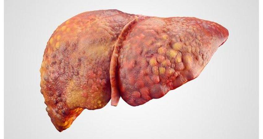 肝脏可能出现健康问题的提示,肝脏疲劳怎么调理