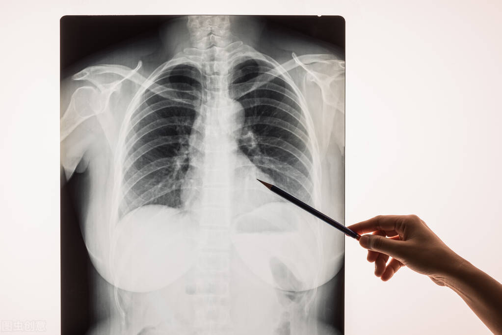 细菌感染头孢和青霉素哪个效果好,细菌感染头孢丙烯还是头孢克肟好