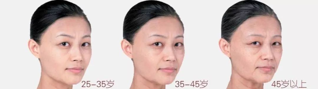 陈乔恩为什么越来越漂亮,陈乔恩肌肤娇嫩