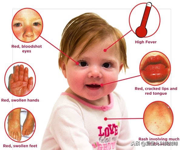 发热白细胞高单核细胞高,发热白细胞高达25什么原因