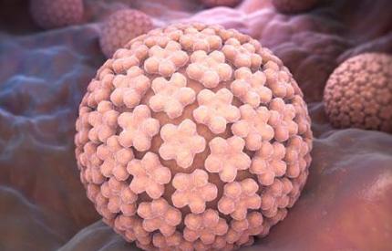 宫颈癌超全知识一次解决你的疑问,宫颈癌常见问题及解决