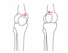 下蹲时膝关节疼痛可能是什么原因,膝关节下蹲到底时疼