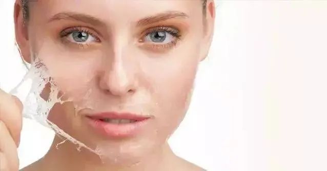 购买含酸化妆品就能居家刷酸对吗,含酸化妆品耐受性