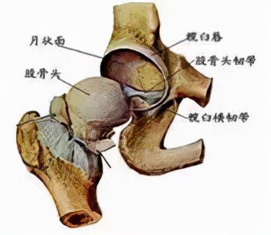 股骨头坏死和腰间盘突出症状区别,椎间盘突出和股骨头坏死症状区别