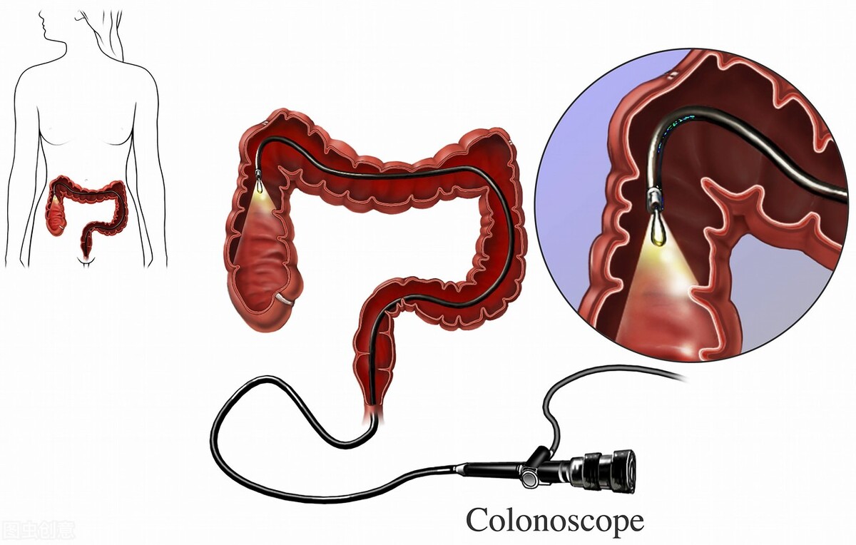 医学博士的忠告,医学博士曝光肿瘤过度治疗