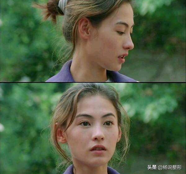 丑小鸭逆袭变天鹅,花3W做鼻整形值不值?术后200天恢复过程分享