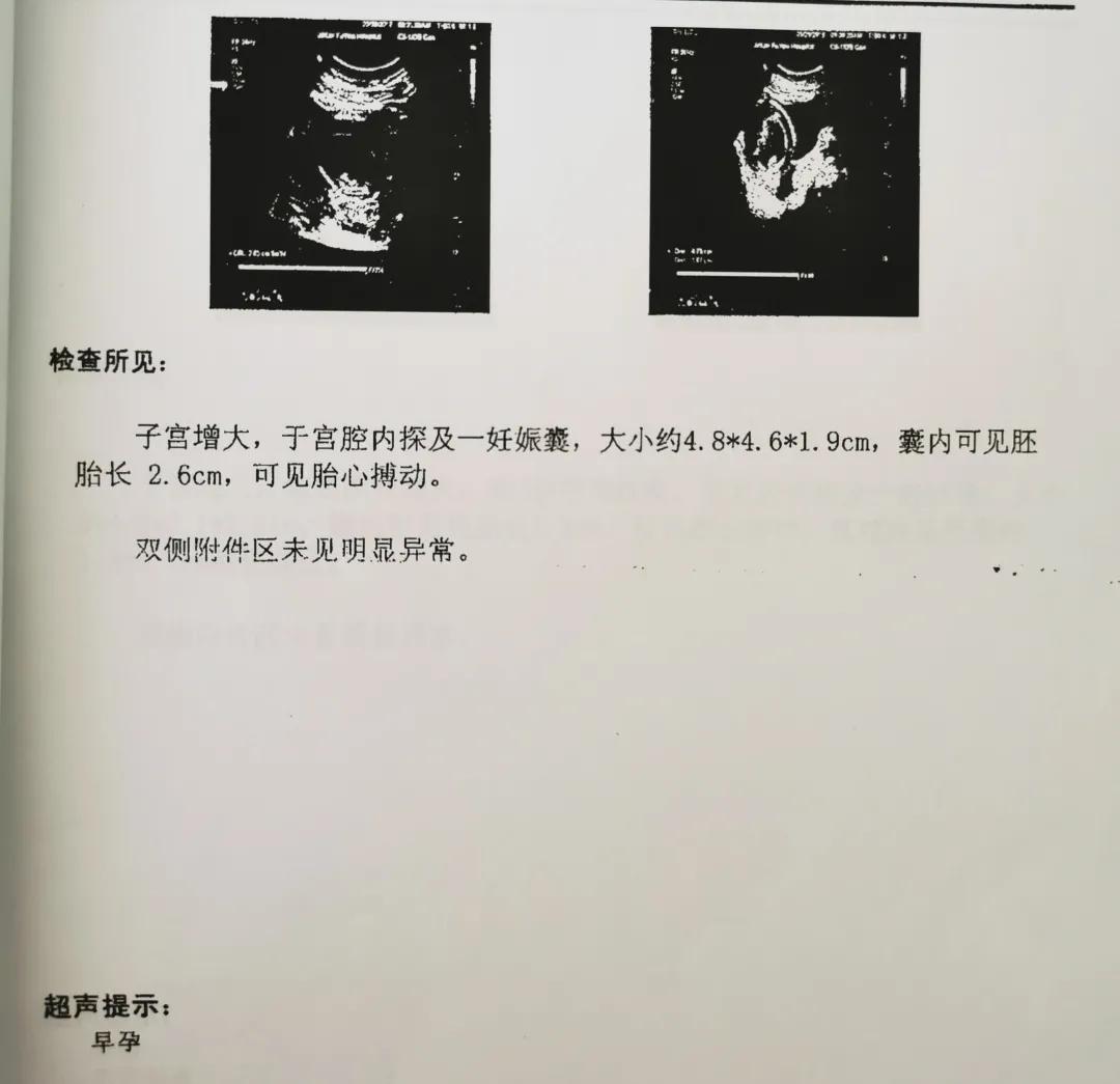 两次引产经历对身体有哪些影响,两年经历两次的引产痛苦