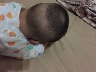 小孩脑袋凹进去一块,小孩头凹下去一圈