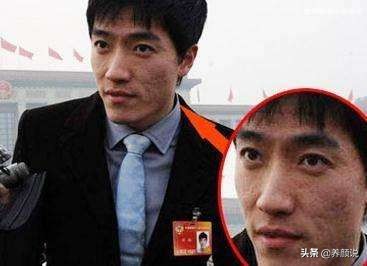 35岁跑步皮肤变化图,跑步后皮肤松弛怎么办