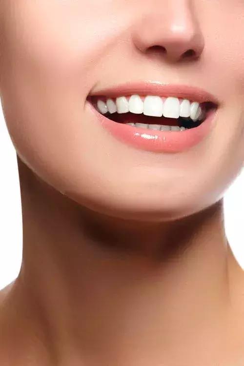 2店通用！66元抢原价420元「单人超声波洗牙套餐」