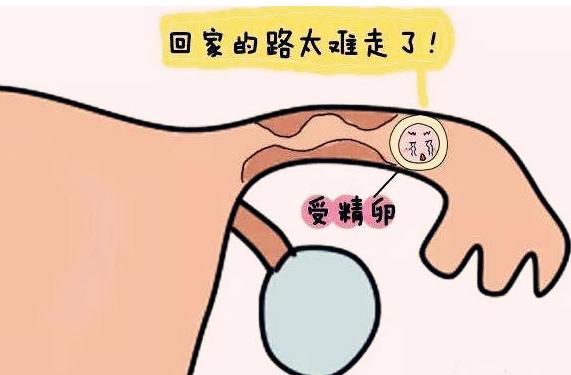 女人宫外孕一般是什么原因造成的,女性宫外孕是什么原因引起的