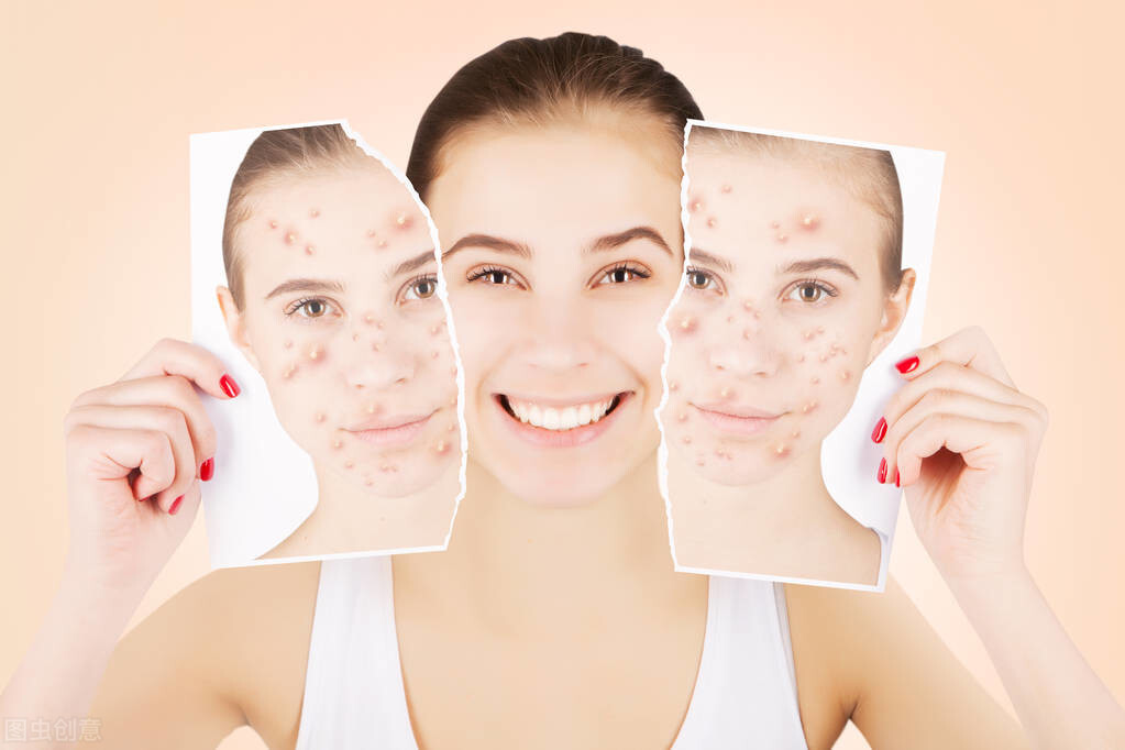 长疮后形成的肉疙瘩怎么去掉,疮疤有个硬疙瘩怎么办