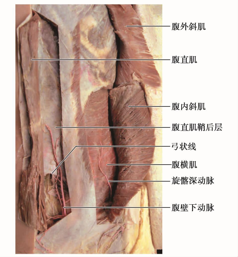 产后腹直肌分离科普视频,产后大肚子腹直肌分离如何恢复