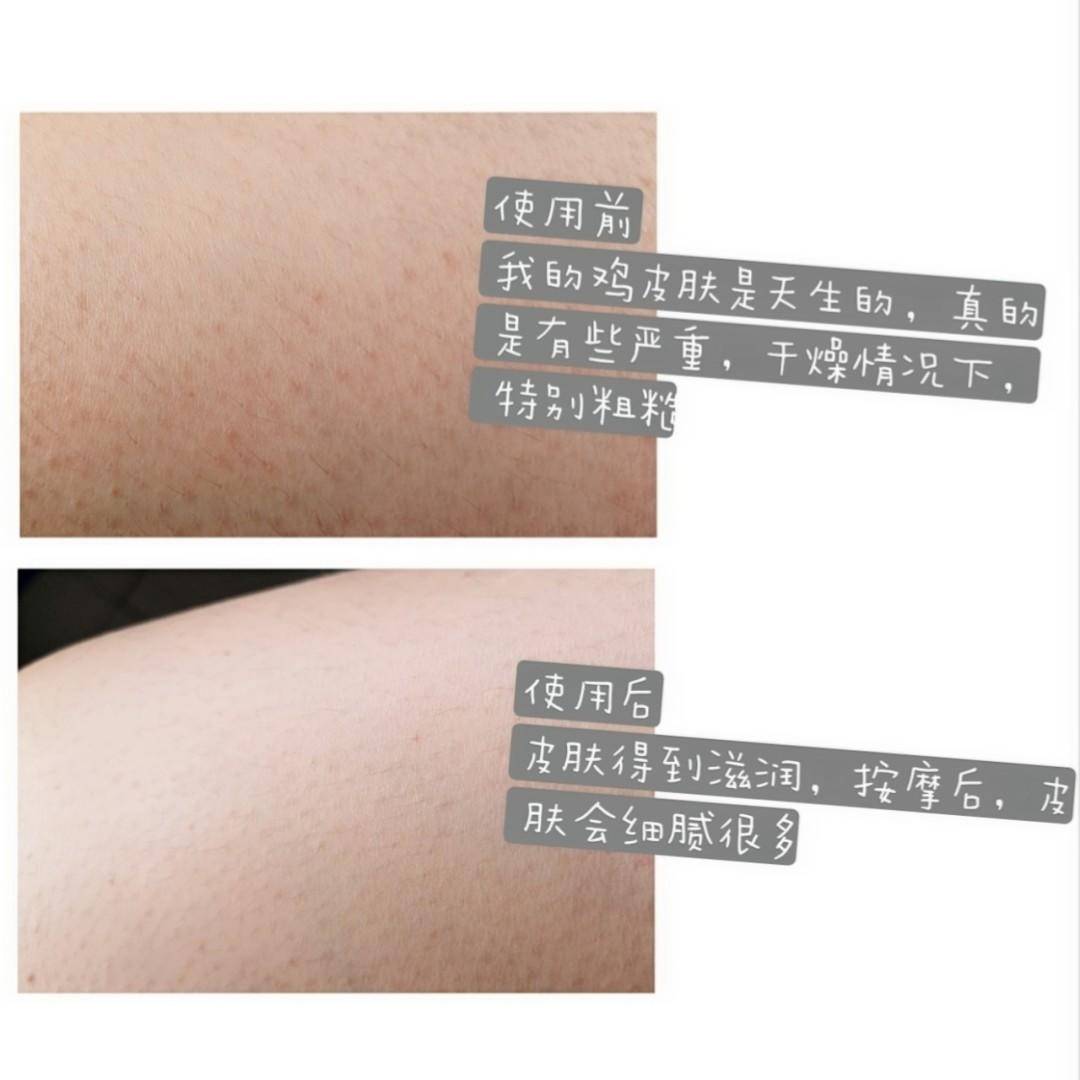 关节黑改善小妙招,关节发黑护肤小妙招