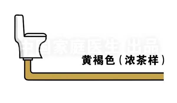 肝肾出现问题所表现的综合征,上厕所有四个症状说明肝有问题