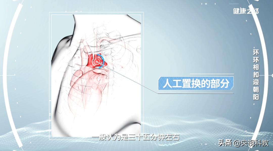 血管主动脉夹层能活多久,警惕凶险的主动脉夹层你了解多少