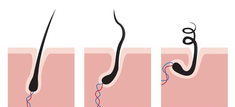 发量增多的实用小技巧,发量超级少的女生咋办啊