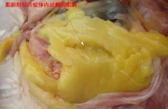 带你了解脂肪和内脏脂肪,带你全面认识脂肪