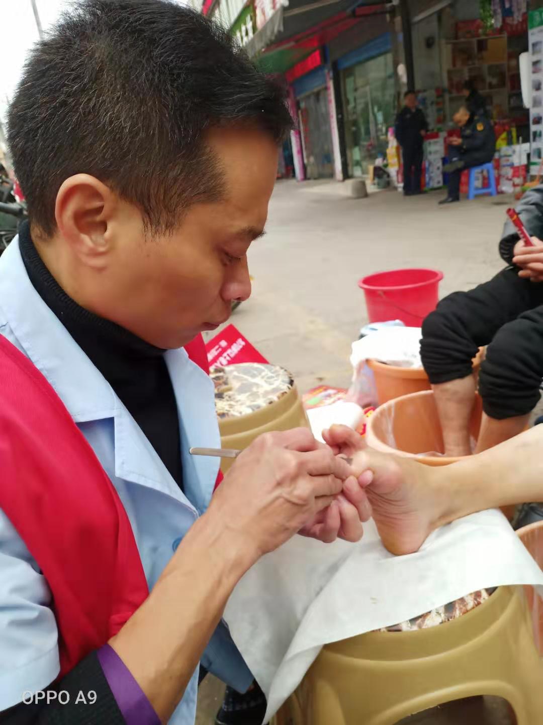 公益修脚直播,公益修脚全国行