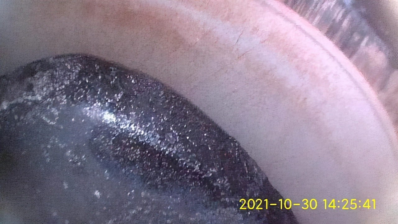 干冰清洗积碳和免拆治理烧机油,奥迪a4干冰清洗积碳解决烧机油