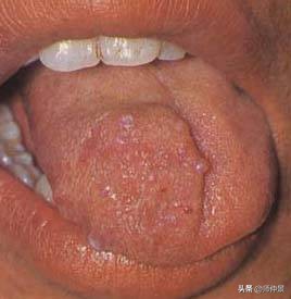 最实用的舌诊图六大舌象,舌诊深入学习书