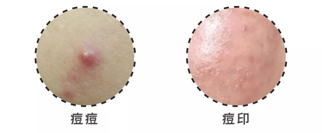 不同年龄段面部抗老精华怎么选,怎样选择适合自己肤质的面部精华