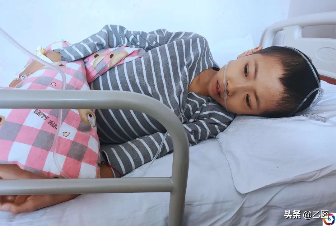 孩子四年经历三次手术,男孩4次开腹手术
