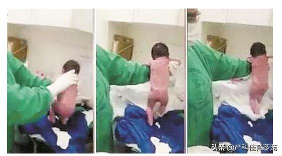 宝宝有时候抖动像吓着一样,宝宝一点动静就惊吓伴有抖动