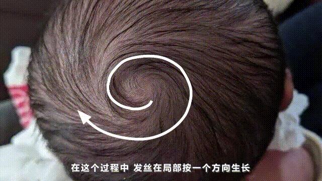 有两个发旋的人智商,发旋会遗传吗