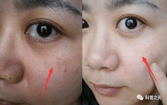 药店白色护肤霜,药店白色的软膏