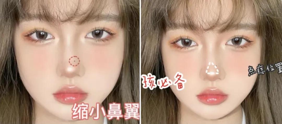 全脸点痣变美,点痣能变美吗