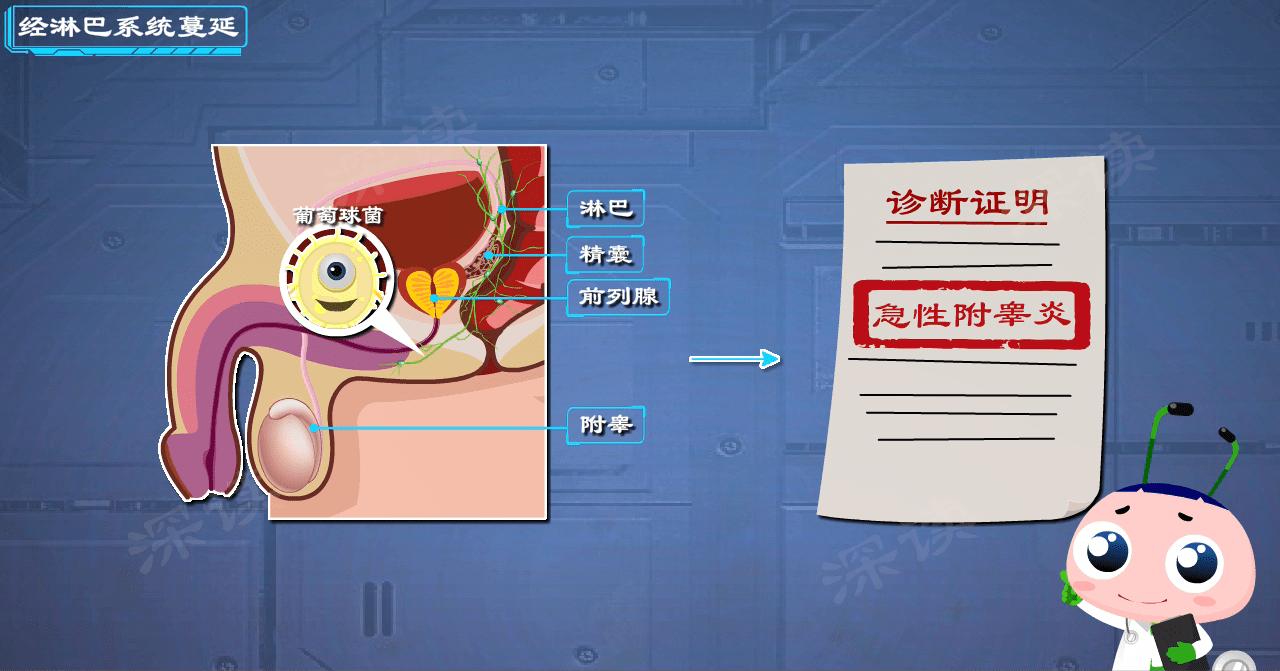 穿错内裤了怎么办,穿错内裤会得什么病