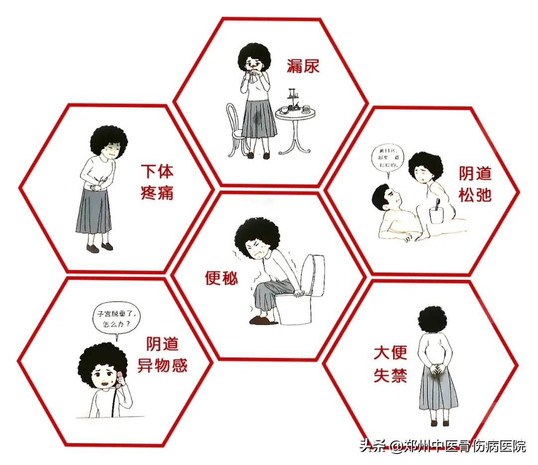 产后宝妈必知盆底肌修复,产后修复每个妈妈的必修课