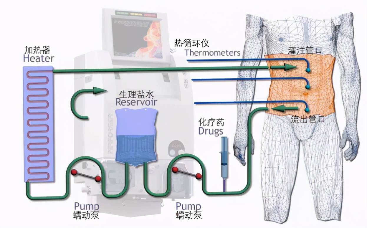 12月12日中山大学孙逸仙纪念医院妇瘤团队走进汾东院区