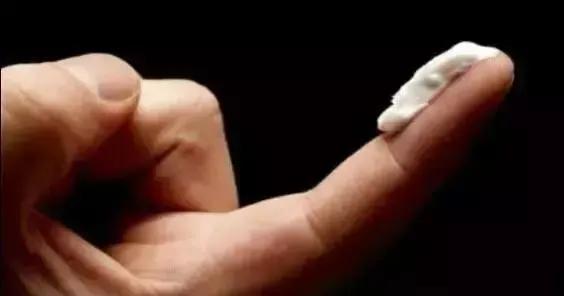 银屑病骗局,银屑病真的是无法治愈吗