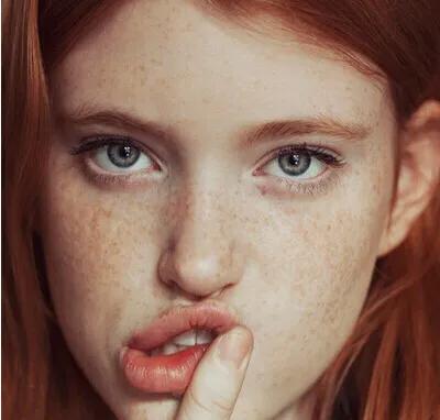 一次搞定雀斑的秘方绝招公开,长了雀斑很难看有一个小妙招