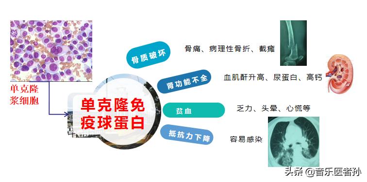 第一次听到消息知道自己的病情,第一次听到自己得癌症的反应