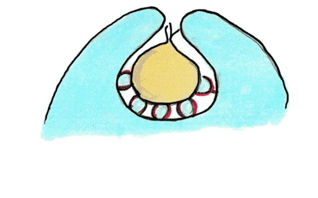 女性妇科癌症有哪些表现,妇科癌症早期10个症状