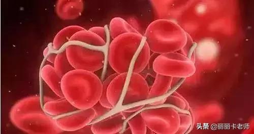 深海鱼油到底该不该吃,深海鱼油可以调理血液粘稠吗