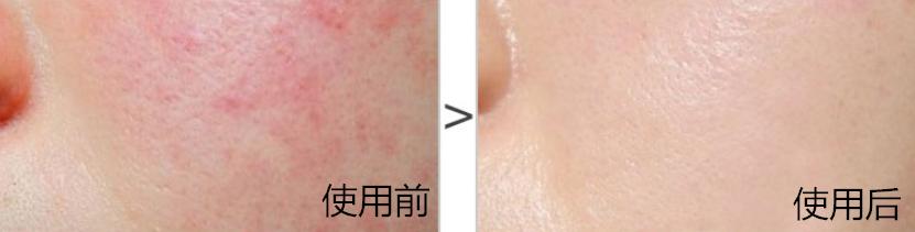 日本蜂王乳面霜,日本的霜好用不过敏干性皮肤用