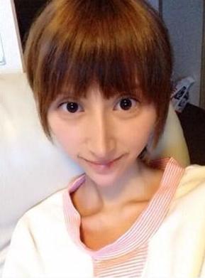 香港女子整容前后,香港女明星整容失败案例