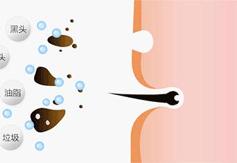 有黑头和没黑头有什么区别,没有长过黑头却长黑头怎么办