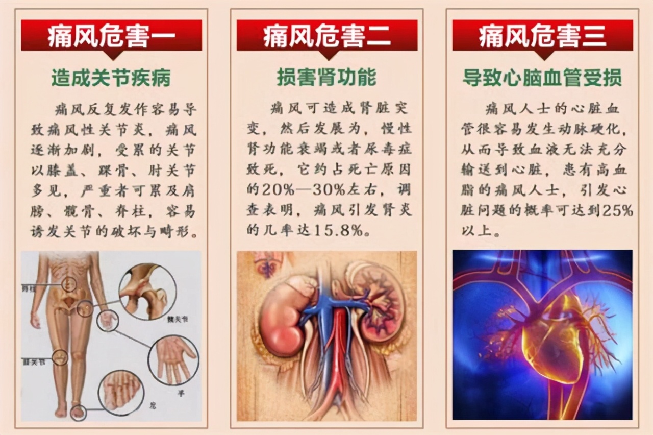 肾尿酸结晶怎么溶解排出体外,细胞代谢的尿酸怎么排出体外