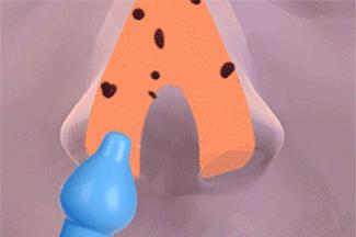 用洗鼻水给宝宝洗鼻子怎么洗,新生儿用什么洗鼻水好