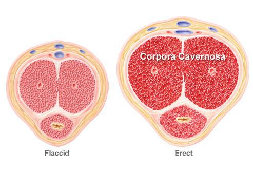 涨姿势！男性勃起障碍很可怕？听过用松紧带和真空泵