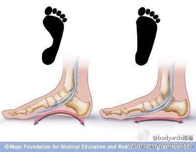 儿童足部常见问题,儿童足部运动康复训练动作大全