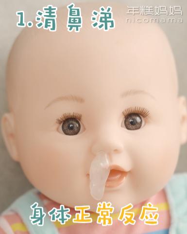 不是感冒一直流鼻涕鼻塞怎么解决,成人不是感冒时不时流鼻涕怎么办