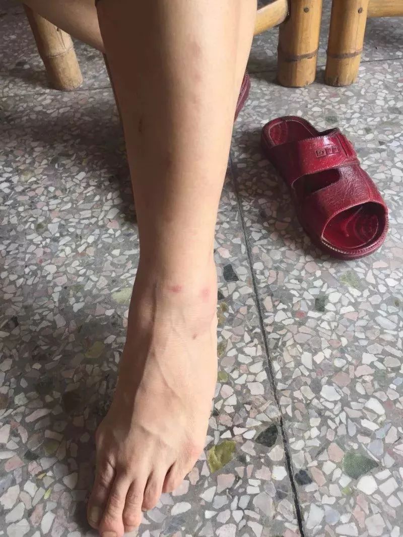 小心路边土堆里的红火蚁,危险路边见到这种虫子千万不要碰