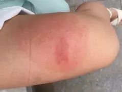 晚上开灯进来好多小飞虫怎么办,晚上开灯就引来很多飞虫是什么