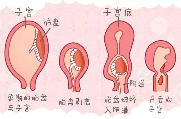 月子恶露排不尽怎么办,月子期间恶露排不出来怎么办